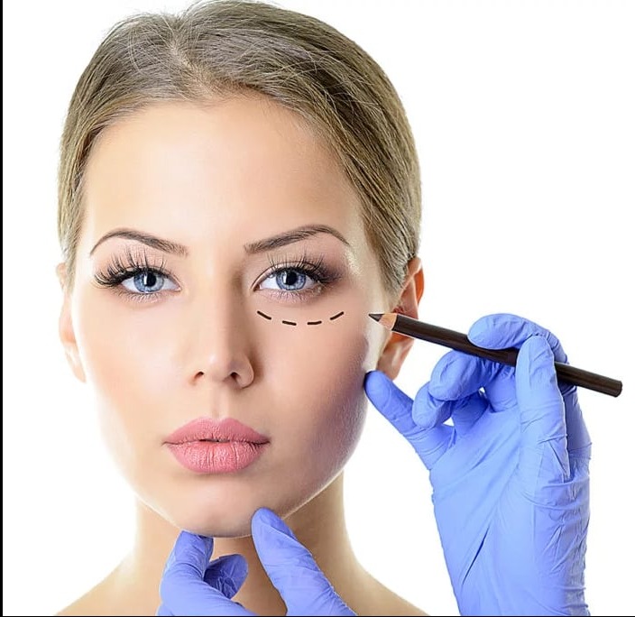 Kobieta z zaznaczonym obszarem pod okiem, przygotowywana do zabiegu, wykonywanym przez osobę w niebieskich rękawiczkach.