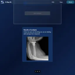 Ekran aplikacji X-Ray IQ do diagnozowania złamań, prezentujący wynik analizy zdjęcia rentgenowskiego przedramienia z widocznym uszkodzeniem kości.