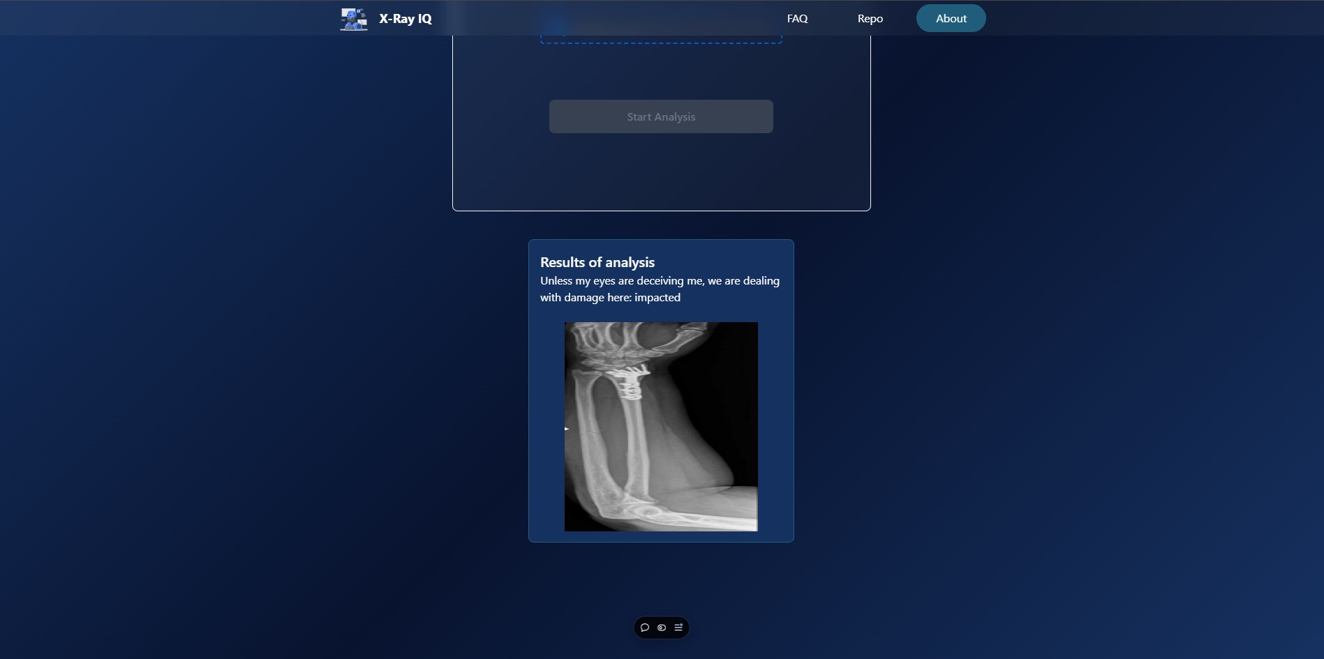 Ekran aplikacji X-Ray IQ do diagnozowania złamań, prezentujący wynik analizy zdjęcia rentgenowskiego przedramienia z widocznym uszkodzeniem kości.
