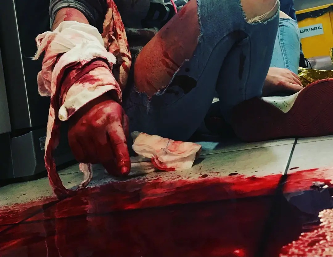 Opatrywanie krwawiącej rany na ręce podczas symulacji wypadku, widoczne zakrwawione bandaże i plamy krwi na podłodze.