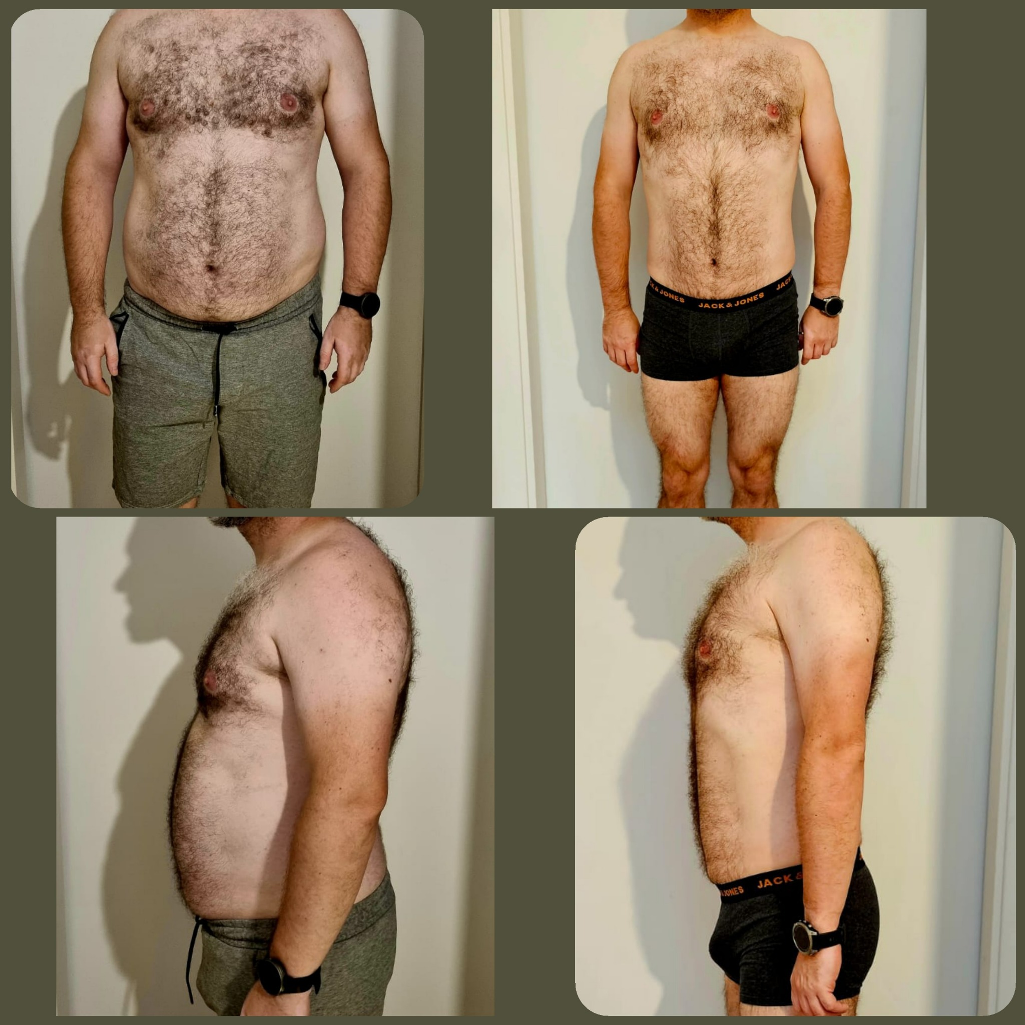 Mężczyzna przed i po odchudzaniu, widoczne zmiany w sylwetce z przodu i z boku, nosi czarny smartwatch.