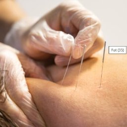 Fizjoterapeuta Łódź 2