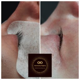 Harmonia Piękna Gabinet Kosmetyczny Karolina Kenkel - Zbliżenie na oko z przedłużonymi rzęsami, widoczne dolne rzęsy i skóra pod okiem po zabiegu, po lewej stronie oko z podkładką ochronną, po prawej oko po zabiegu przedłużania rzęs. W tle logo firmy.