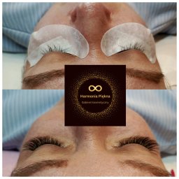 Harmonia Piękna Gabinet Kosmetyczny Karolina Kenkel - Zbliżenie na twarz kobiety przed i po zabiegu przedłużania rzęs; widoczne białe płatki pod oczami w górnej części zdjęcia i gęste, długie rzęsy w dolnej części, zasłonięte logo gabinetu kosmetycznego.