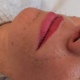 Harmonia Piękna Gabinet Kosmetyczny Karolina Kenkel - Twarz kobiety z zaznaczonymi punktami na skórze wokół ust, przygotowana do zabiegu z zakresu medycyny estetycznej, widoczne czerwone usta i fragment białego podkładu.