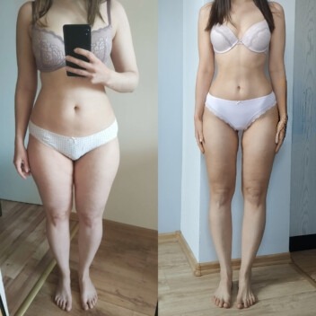 Zdjęcie 'przed i po' przedstawiające sylwetkę kobiety w bieliźnie, z widoczną różnicą w wyglądzie brzucha, ud i ogólnej postury. Po lewej stronie kobieta robi selfie telefonem, po prawej stoi...