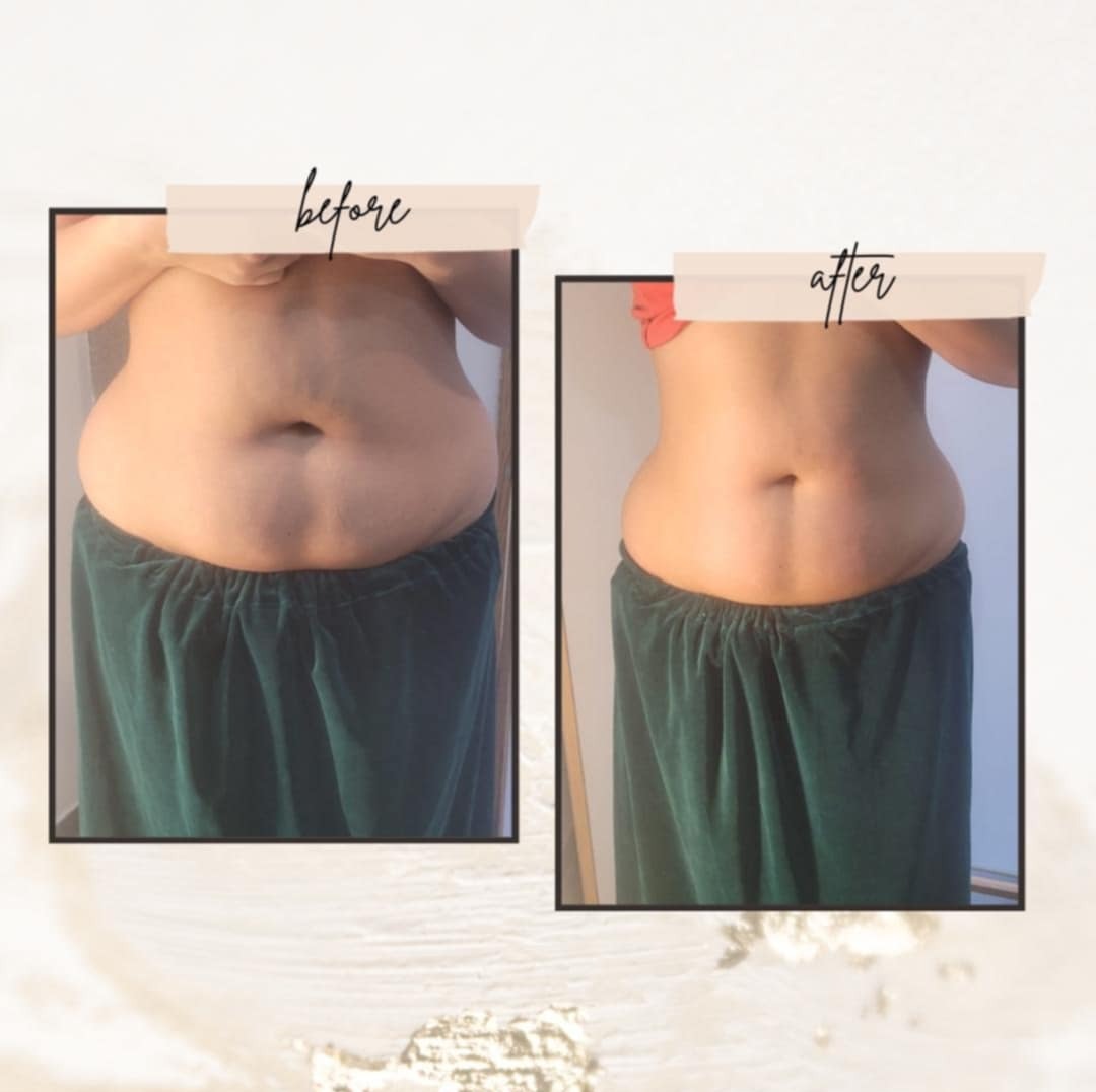 Modelowanie sylwetki 'efekt po 1 zabiegu