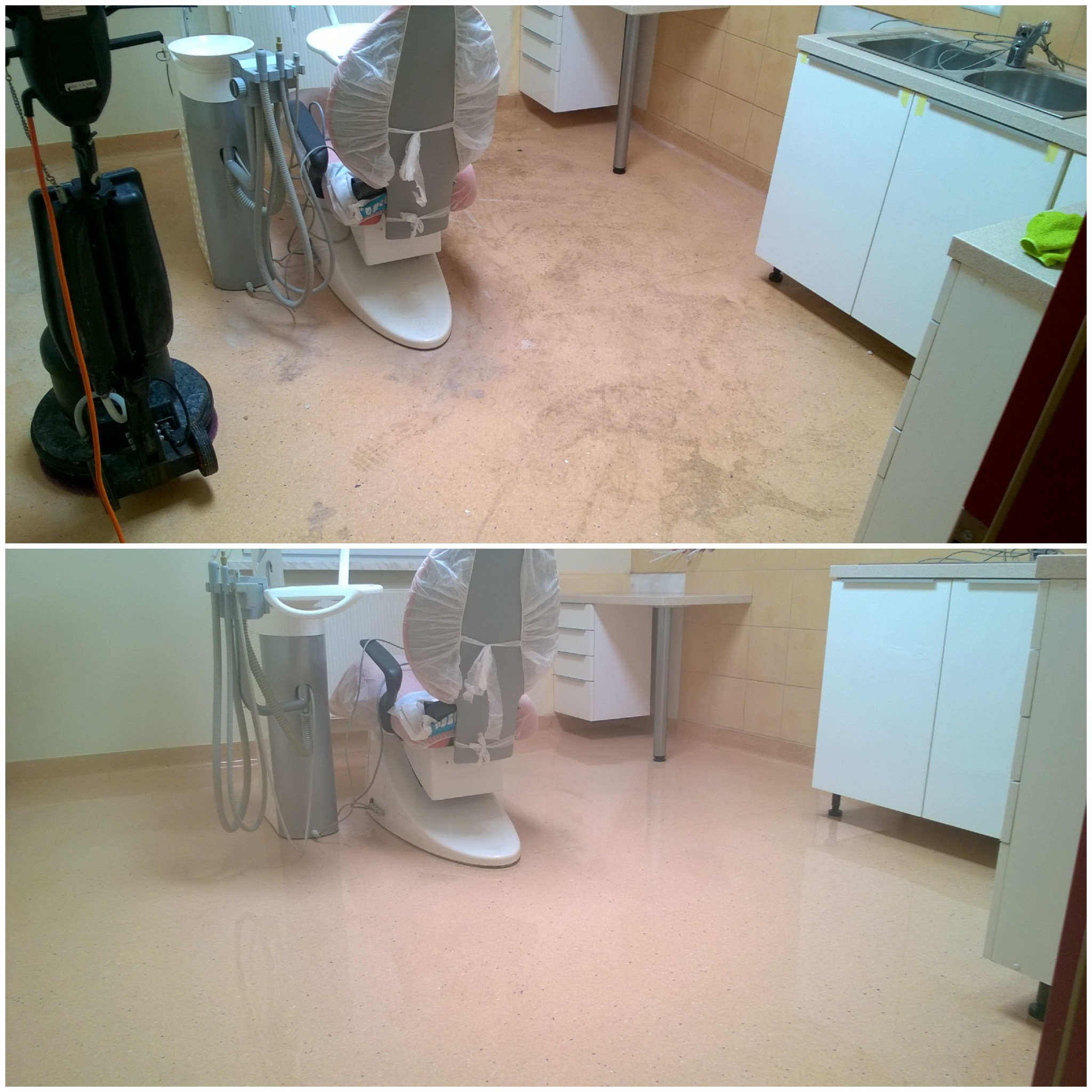 Porównanie stanu podłogi w gabinecie dentystycznym: widoczna różnica przed i po mechanicznym czyszczeniu, z użyciem specjalistycznej maszyny i widocznym wyposażeniem stomatologicznym.