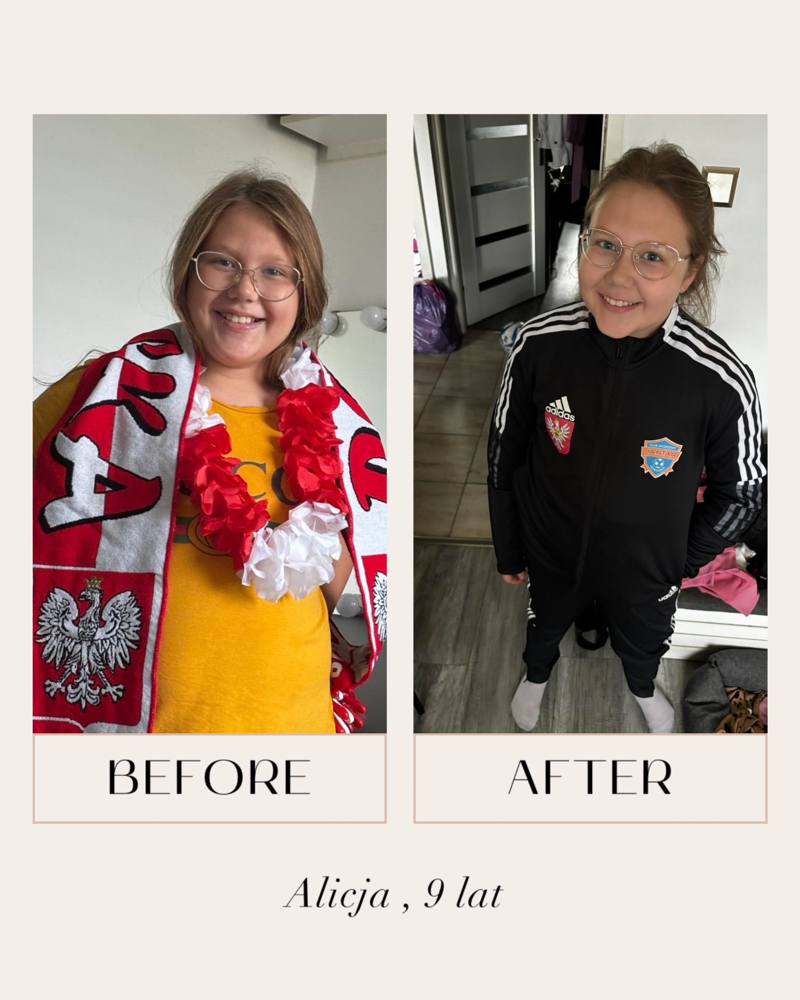 Porównanie wyglądu dziewczynki przed i po prawdopodobnej zmianie diety lub stylu życia: po lewej z szalikiem kibica i kwiatami, po prawej w dresie sportowym.