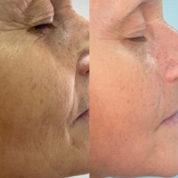 Masaż Sucha Beskidzka 3