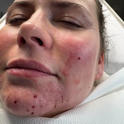 Pielęgniarskie Skoczów 1