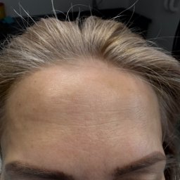 Pielęgniarskie Skoczów 2