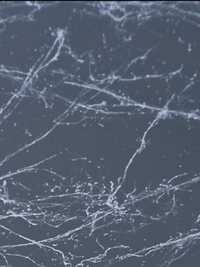 Szara posadzka żywiczna z białymi, nieregularnymi wzorami przypominającymi marmurkową strukturę. Jasne linie przecinają ciemne tło, tworząc unikalny efekt wizualny.