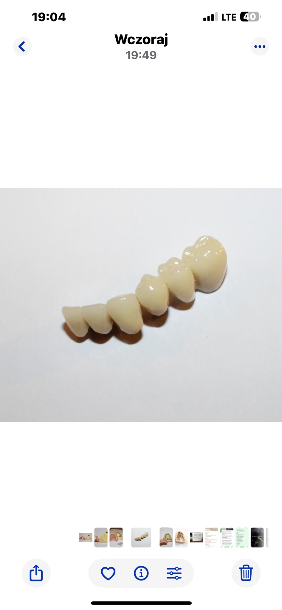 Most protetyczny z jasnego porcelanu, ukazujący pięć zębów, ułożony na białym tle pod delikatnym kątem, prezentujący ich kształt i połysk.