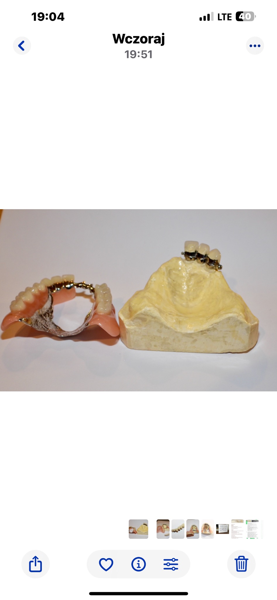 Wyjmowana proteza szkieletowa z metalową bazą i akrylowymi zębami, obok gipsowego modelu szczęki z zamocowanymi elementami protetycznymi.