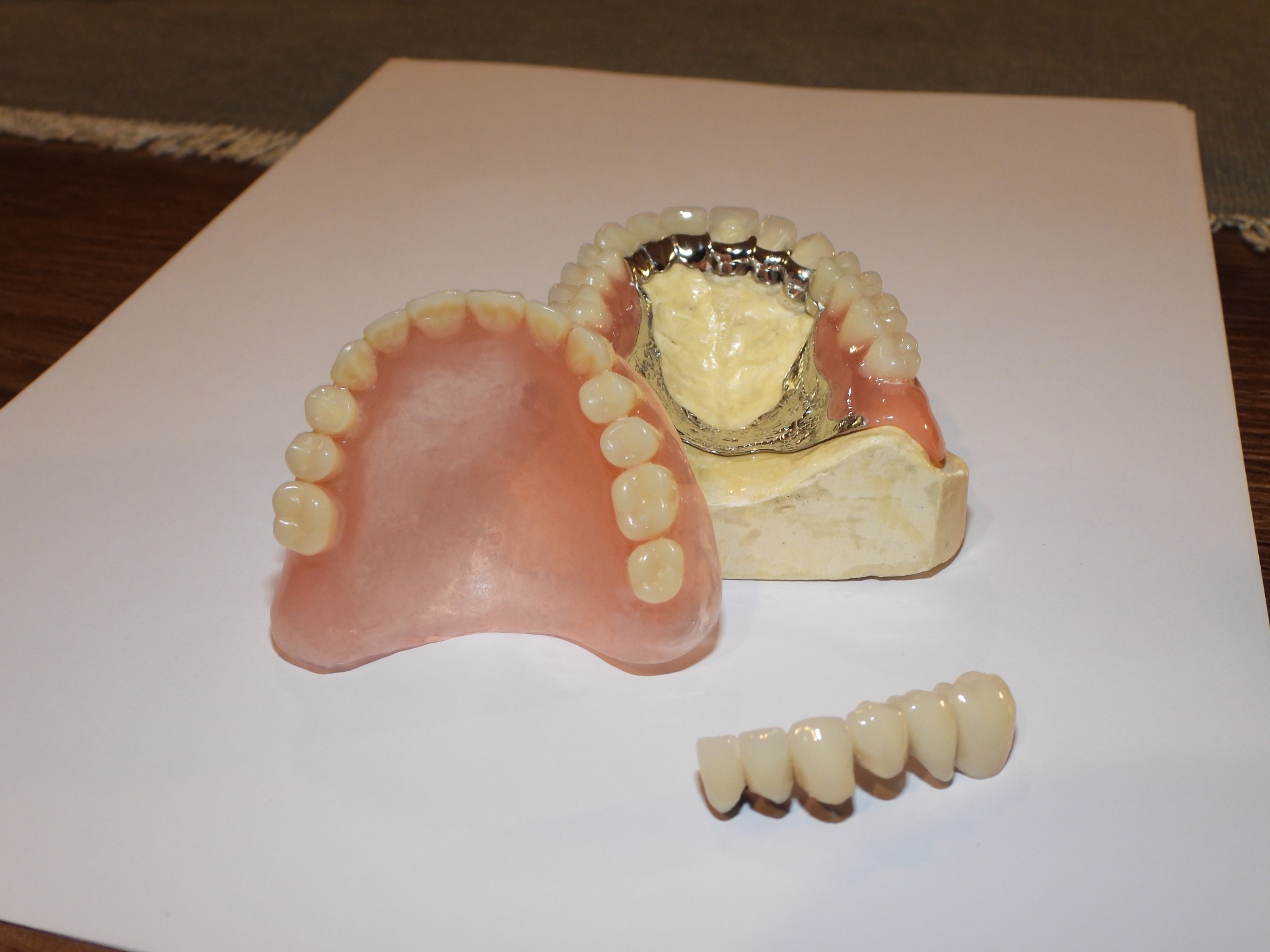 Trzy różne protezy dentystyczne: górna z metalową konstrukcją, dolna różowa oraz most z czterech zębów, ułożone na białym papierze.