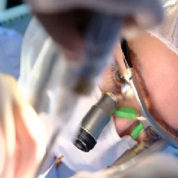 Dentina Anna Górska Tarnów - dentysta - protetyka- wybielanie zębów - Pacjent podczas zabiegu stomatologicznego z użyciem mikroskopu, widoczne zielone paski ochronne i narzędzia w dłoniach lekarza.