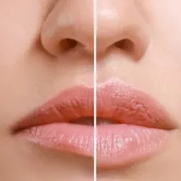 Zbliżenie na kobiece usta przed i po zabiegu, z widoczną różnicą w nawilżeniu i objętości, delikatne oświetlenie.