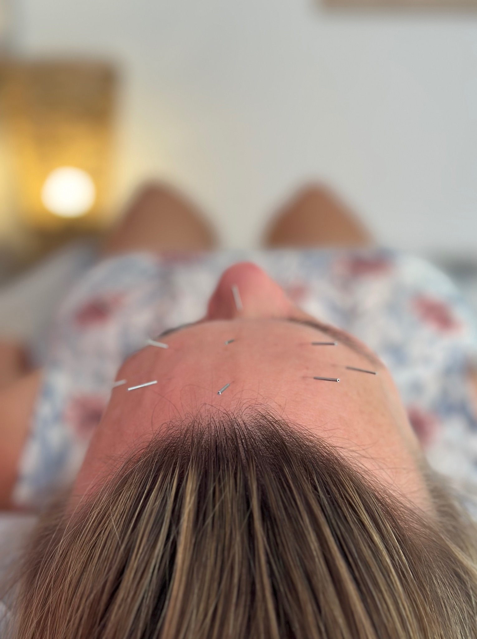 Widok z dołu na twarz kobiety z cienkimi metalowymi igłami wbitymi w czoło, leżącej na kwiecistej pościeli w gabinecie, z rozmytym światłem w tle.