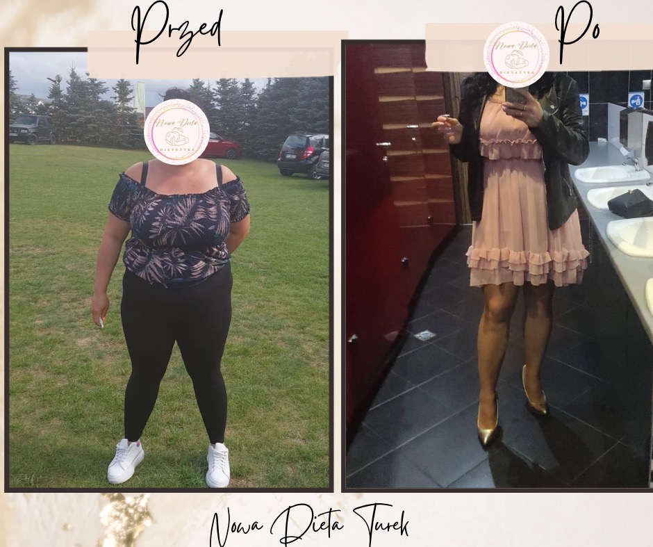 Zdjęcie typu 'przed i po' przedstawia sylwetkę kobiety przed i po diecie. Zmiana sylwetki, inny strój i otoczenie. Logo 'Nowa Dieta Turek' na zdjęciu.