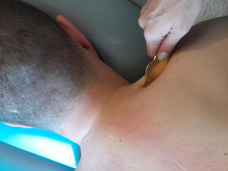 Terapia manualna: złoty skrobak na karku pacjenta, widok z góry. Delikatne zaczerwienienie skóry. Dłoń terapeuty w jasnym oświetleniu.