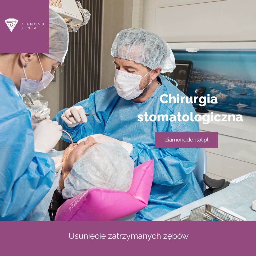 Chirurgia stomatologiczna w Diamond Dental: zabieg usunięcia zęba zatrzymanego, widok z góry, personel medyczny w strojach ochronnych, nowoczesne wyposażenie.