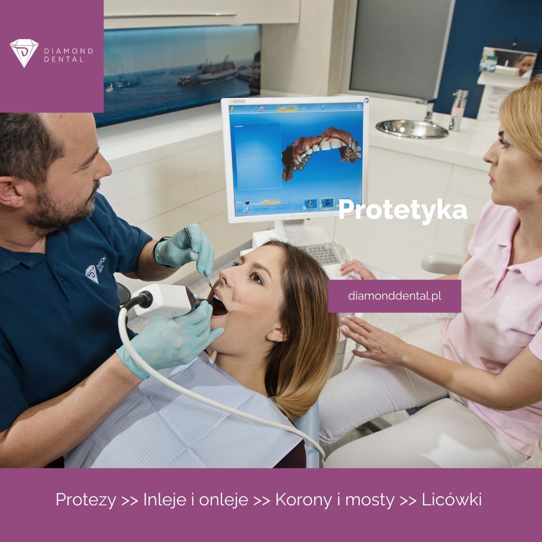 Skanowanie 3D jamy ustnej pacjentki w gabinecie stomatologicznym Diamond Dental, z widocznym modelem uzębienia na monitorze. Lekarz i asystentka podczas zabiegu.