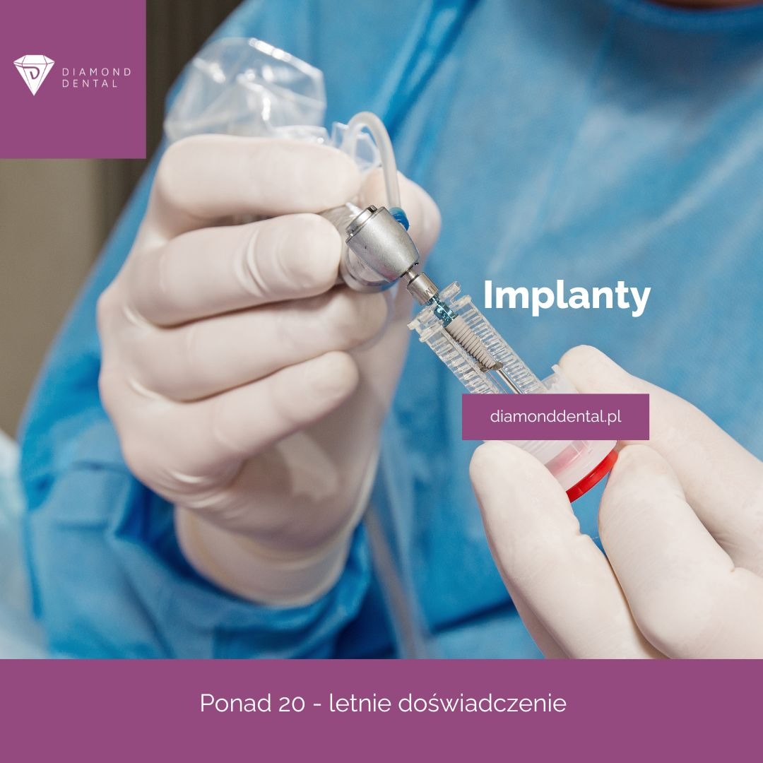 Stomatolog przygotowuje implant. Wiertło i implant w strzykawce, dłonie w rękawicach, niebieskie tło. Precyzyjny zabieg implantacji w Diamond Dental.