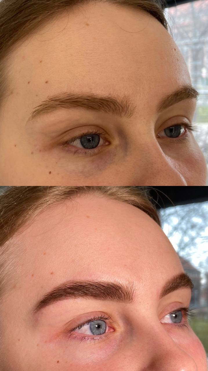 Zdjęcie 'przed i po' prezentujące brwi po zabiegu koloryzacji i regulacji. Widoczne różnice w kształcie i odcieniu brwi, podkreślone naturalne piękno.