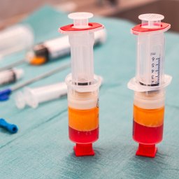 ArthroClinic Ortopedia i Fizjoterapia Puck - Komórki macierzyste do kolana