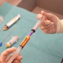 ArthroClinic Ortopedia i Fizjoterapia Puck - Przygotowanie do iniekcji komórek macierzystych: strzykawka z pomarańczowym płynem w dłoni w rękawiczce, inne strzykawki i narzędzia na zielonym podkładzie.