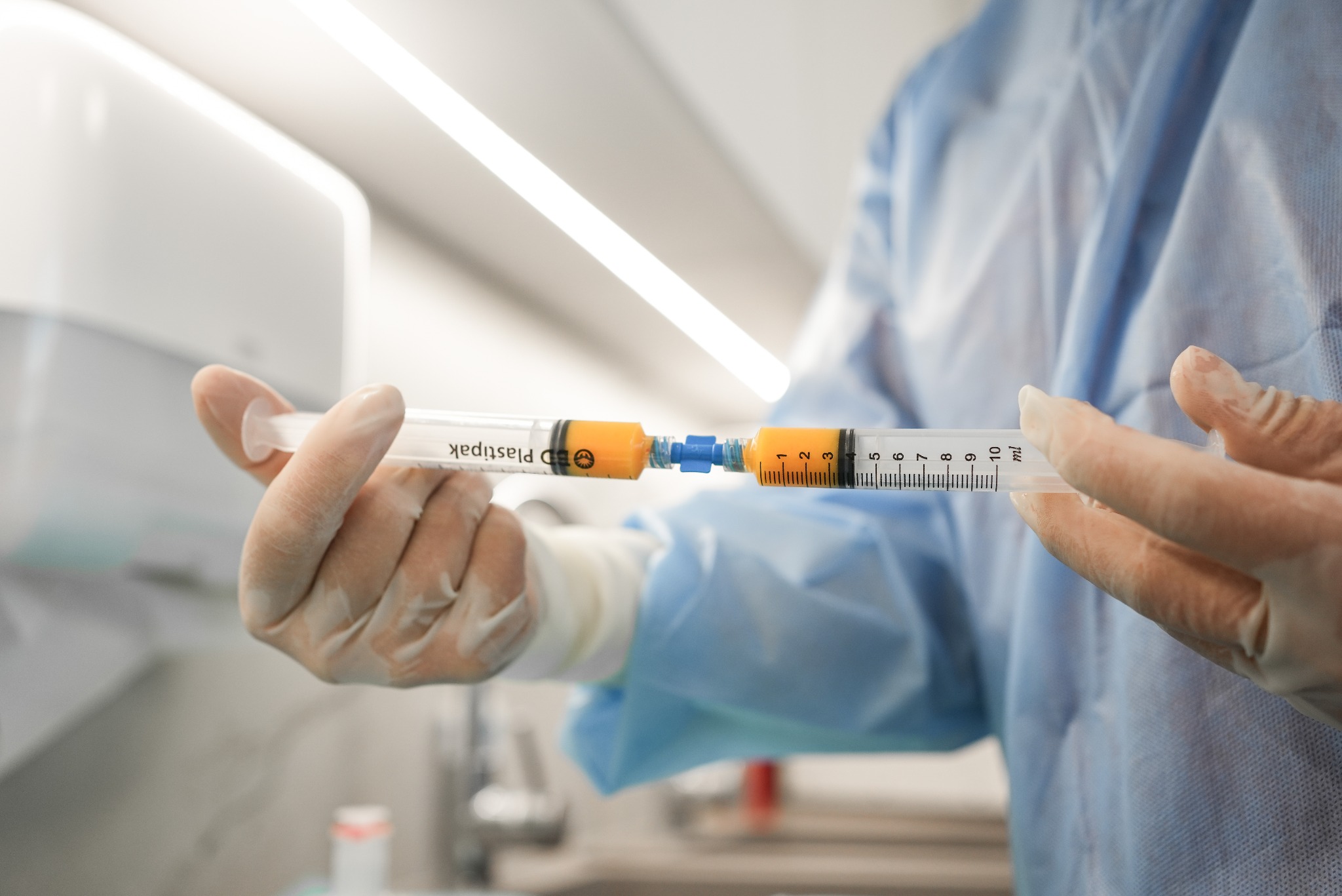 Dwie strzykawki połączone łącznikiem, wypełnione pomarańczowym płynem, trzymane w dłoniach w rękawiczkach, na tle jasnego, sterylnego pomieszczenia zabiegowego.