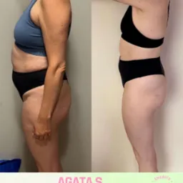 Efekt 3-miesięcznej wsp&oacute;łpracy: metamorfoza sylwetki kobiety, widoczna zmiana w talii i udach, por&oacute;wnanie 'przed' w niebieskim stroju i 'po' w czarnym.