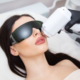 OG Cosmetology - Kobieta w okularach ochronnych poddawana zabiegowi laserowemu na twarzy. Widoczny aplikator i dłoń w czarnej rękawiczce.