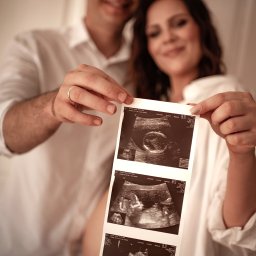 SASHA ART BEAUTY Oleksandra Melnychenko - Uśmiechnięta para prezentuje wydruk USG ciąży. Kobieta w białej koszuli, w tle mężczyzna z obrączką. Romantyczna pamiątka z sesji ciążowej.