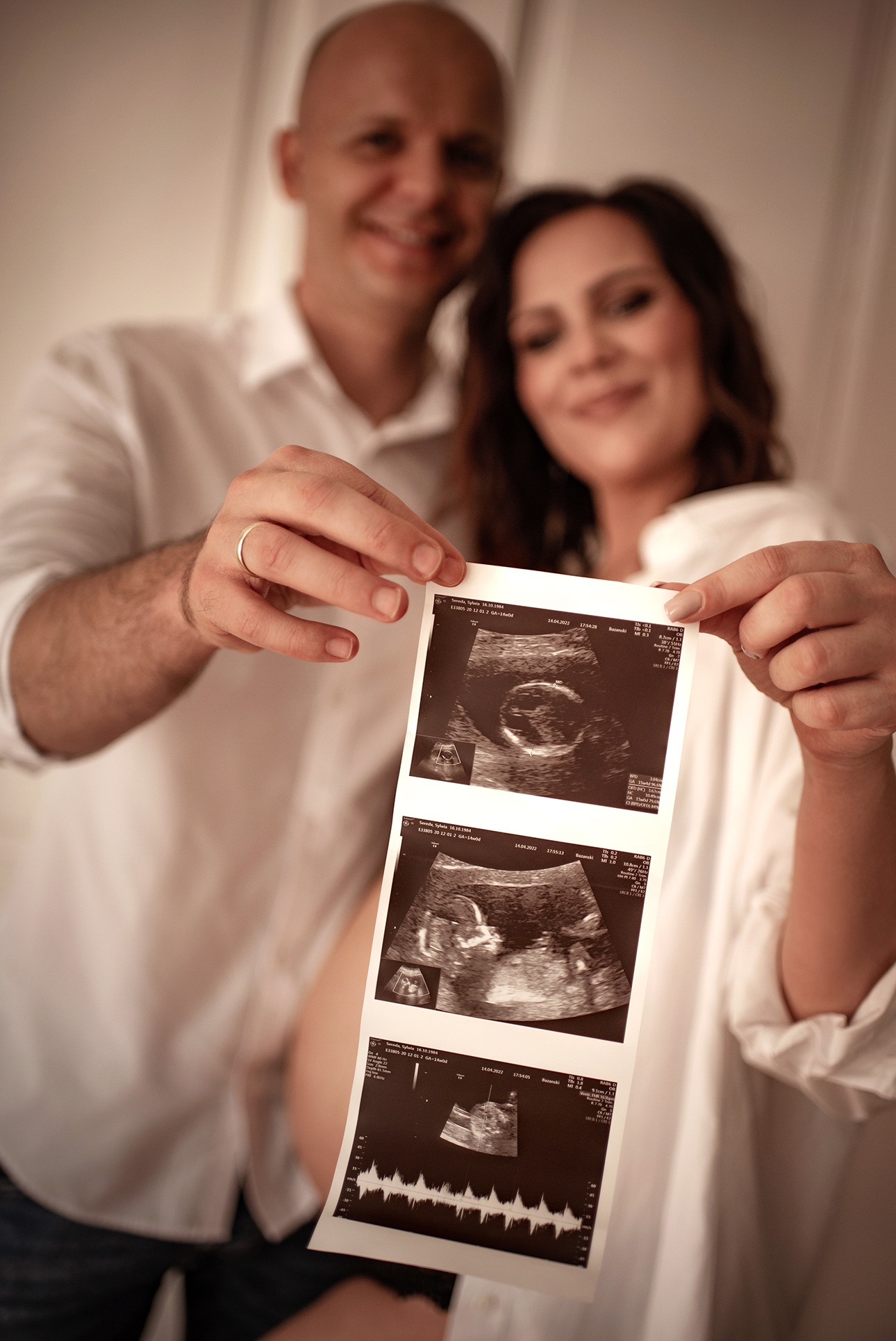 Uśmiechnięta para prezentuje wydruk USG ciąży. Kobieta w białej koszuli, w tle mężczyzna z obrączką. Romantyczna pamiątka z sesji ciążowej.