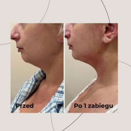 Manicure i pedicure Wrocław 3