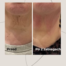 Manicure i pedicure Wrocław 2