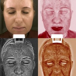 Dermamed - Komputerowa analiza skóry w Dermamed centrum medycyny estetycznej