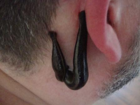 Hirudoterapia: dwie pijawki lekarskie przyssane do ucha pacjenta z widocznym zarostem, zbliżenie.