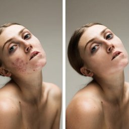 Grafmaga - Portret kobiety przed i po retuszu. Po lewej widoczne zmiany skórne, po prawej skóra wygładzona. Neutralne tło, naturalne światło, delikatny makijaż.