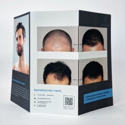 NOKO-CREATE PATRYK WOJEWODZIC - Trójdzielna broszura z przykładami przeszczepu włosów 'przed i po', dane kontaktowe kliniki medycyny estetycznej, portret mężczyzny. Broszura leży na białym tle.