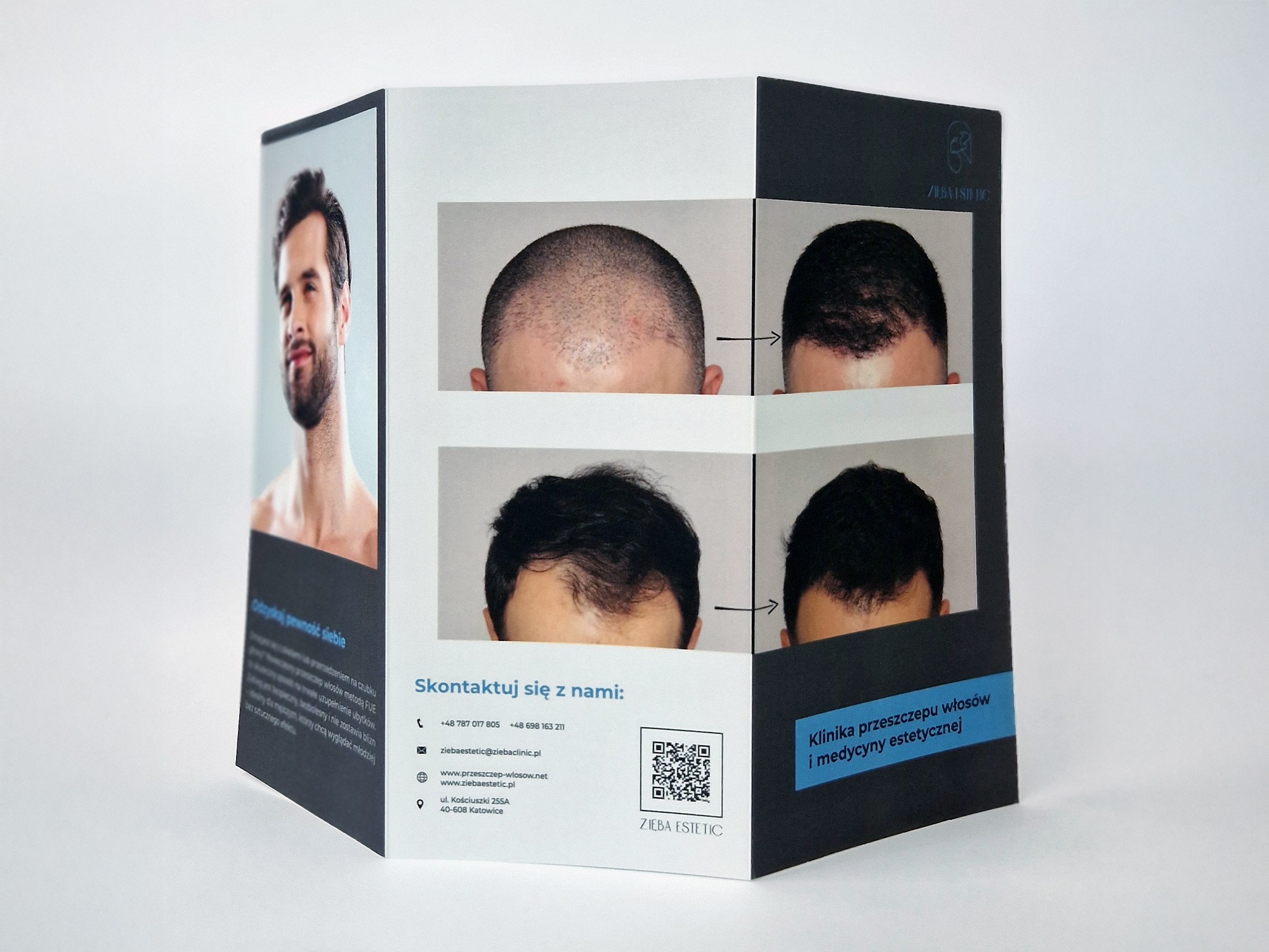 Trójdzielna broszura z przykładami przeszczepu włosów 'przed i po', dane kontaktowe kliniki medycyny estetycznej, portret mężczyzny. Broszura leży na białym tle.