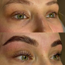 Zabiegi na ciało Zakopane 3