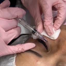 Zabiegi na ciało Zakopane 2