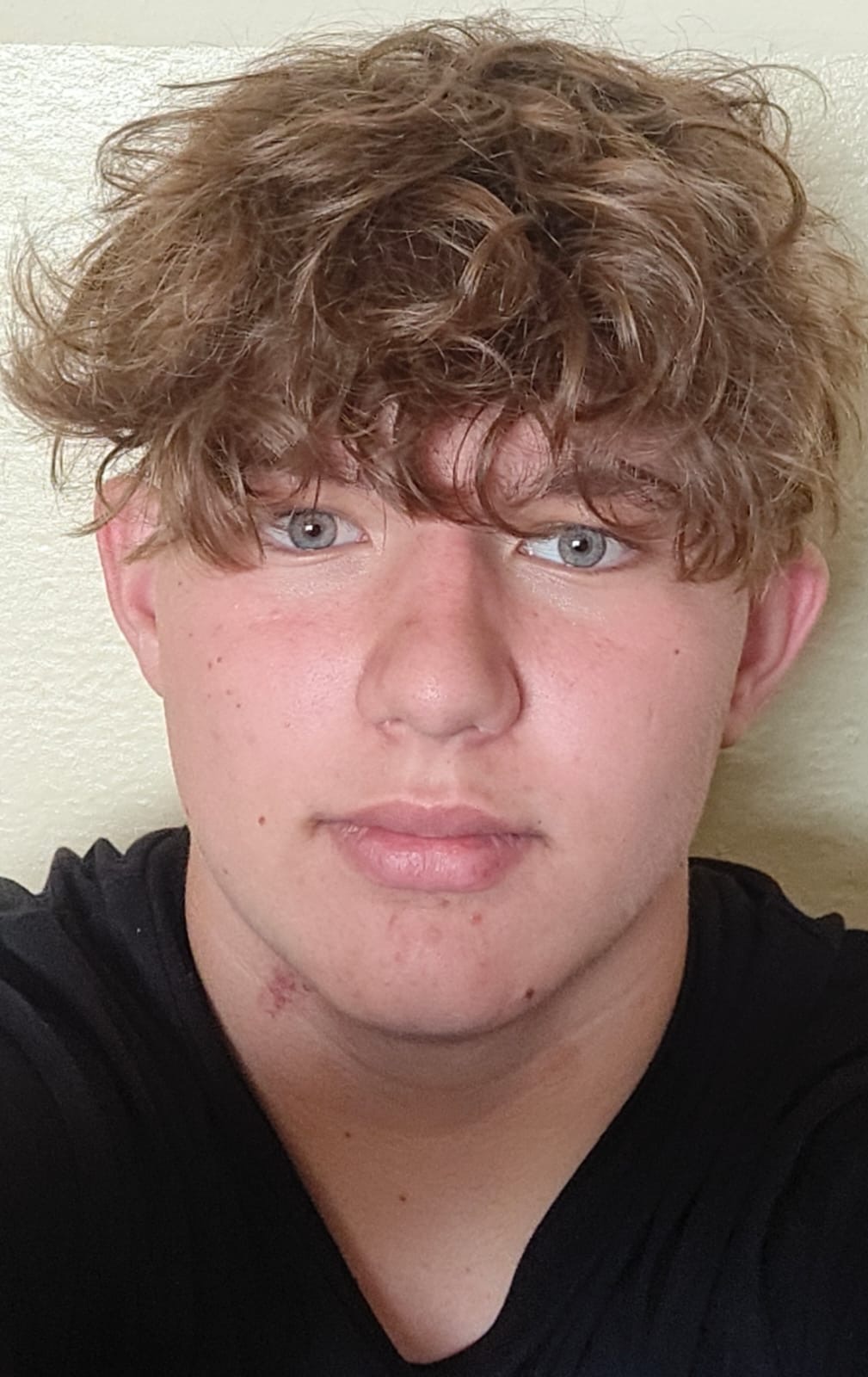 Portret młodego mężczyzny z kręconymi włosami i jasnymi oczami, ubrany w czarną koszulkę. Widoczny fragment śladu na szyi. Neutralne tło.