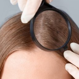 GABINET TRYCHOLOGICZNY WŁOS DOSKONAŁY MARTA ŚWITOŃ - Masaż Twarzy Olsztyn