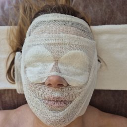 BLASK NATURY GRZEGORZ JASIAK - Kobieta leży na plecach z twarzą owiniętą w gazę i waciki na oczach, przygotowana do zabiegu kosmetycznego. Widok z góry, neutralne oświetlenie.