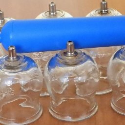 Bańki lekarskie bezogniowe. Obecnie bańki lekarskie na nowo powracają do łask, więc warto dowiedzieć się więcej na temat zalet i wad tego sposobu wspomagania leczenia różnych schorzeń. 