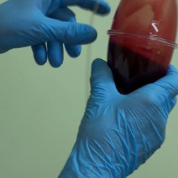 Usługi pielęgniarskie NZOZ mgr Beata Kluczkiewicz Zielona Góra - Dłoń w niebieskiej rękawiczce trzyma worek z krwią z cewnikiem. Widoczny fragment drugiej dłoni w rękawiczce i złota bransoletka na nadgarstku.